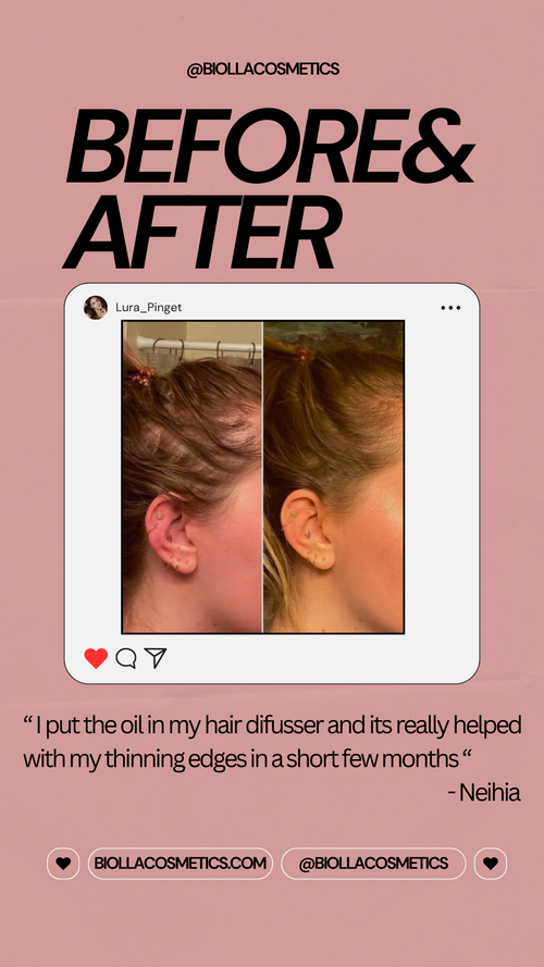For Hair Loss
