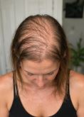 Olga before