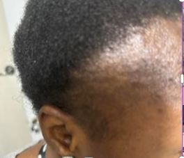 Ivie before