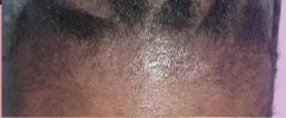 Ivie after