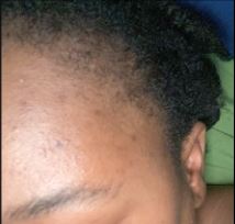 Ashley after