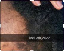 Ashley before